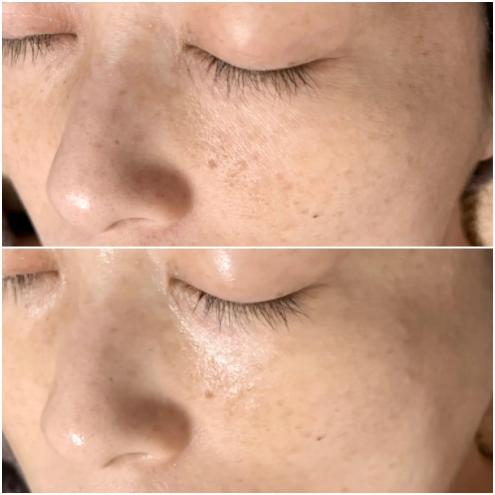 乾燥知らずのうる艶肌へ✨｜亀岡市｜エステ