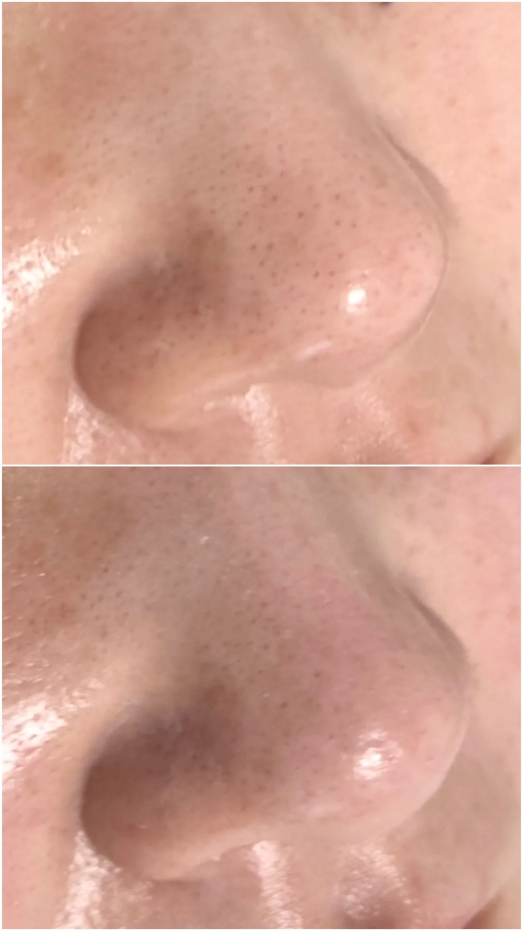 ３月も、もう終わり❣️新生活がまもなくスタート🤗お手入れするなら今！！｜エステ｜亀岡｜南丹市