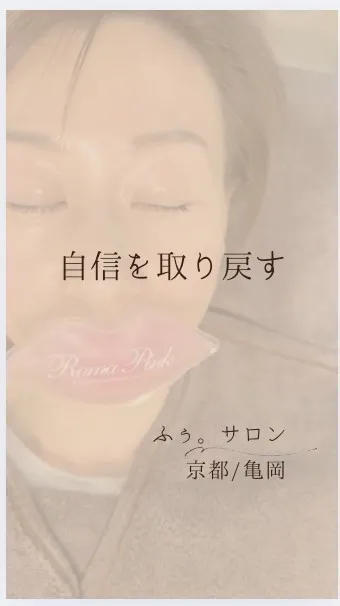𝚁𝚘𝚖𝚊 𝚙𝚒𝚗𝚔（ローマピンク）｜最新メラニンケア｜リップ...